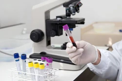 Papanduva abre licitação para equipamentos de laboratório