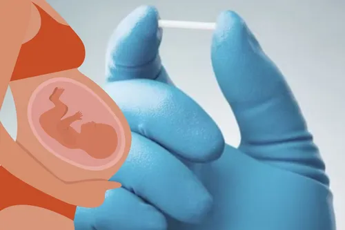 Papanduva oferece implante contraceptivo de longa duração