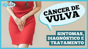 Imagem para matéria Já ouviu falar de câncer de vulva? Caroço, coceira e feridas podem ser sintomas 