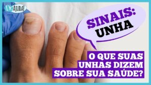 Imagem para matéria Dr. Ajuda: Unhas fracas podem indicar problemas de saúde 